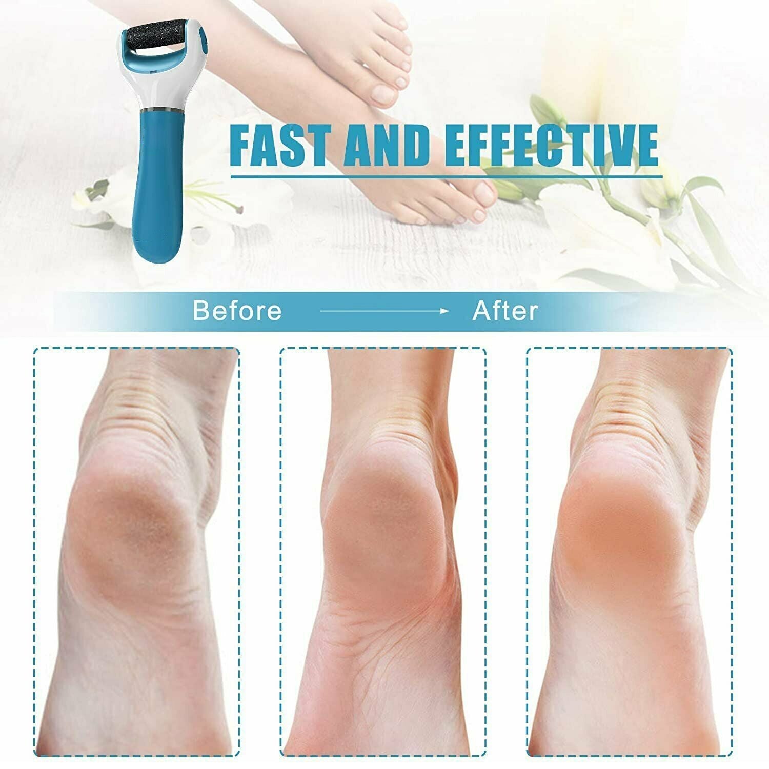 0229 Electronic Dry Foot File, Callous Remover for Feet, Electric Foot with Roller Hard and Dead Skin- Regular Coarse, Baby smooth feet in minutes. For in home padicure foot care, Battery Powered & USB (Battry not included) 0229 Electronic Dry Foot File, Callous Remover for Feet, Electric Foot with Roller Hard and Dead Skin- Regular Coarse, Baby smooth feet in minutes. For in home padicure foot care, Battery Powered & USB (Battry not included)